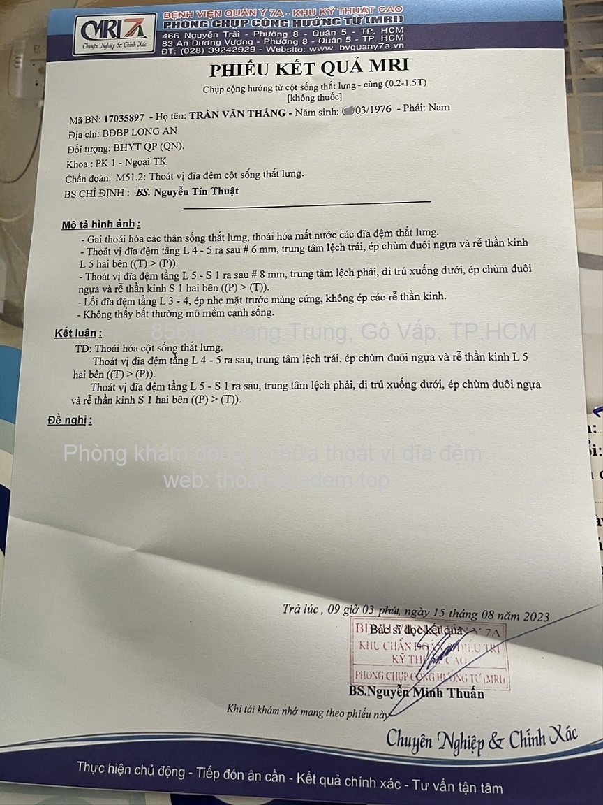 Chèn ép rễ thần kinh